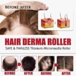 Close-up views of advanced hair derma roller results highlighting scalp improvements and hair thickness.