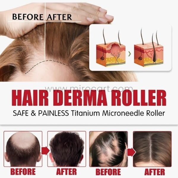 Close-up views of advanced hair derma roller results highlighting scalp improvements and hair thickness.