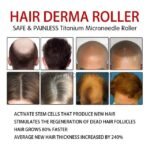 Collage of advanced hair derma roller results emphasizing benefits like 80% faster growth and 240% thicker hair.