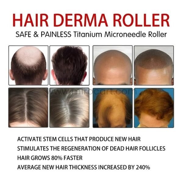 Collage of advanced hair derma roller results emphasizing benefits like 80% faster growth and 240% thicker hair.